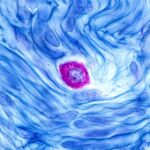 Lors d’une réponse allergique, certaines cellules immunitaires en digèrent d’autres