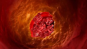 La thérapie par cellules en T pourrait aider à prévenir les artères obstruées