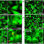 Les émissions de biomasse âgées pourraient présenter un risque plus important pour les poumons que la fumée de forêt fraîche Les émissions de biomasse âgées pourraient présenter un risque plus important pour les poumons que la fumée de forêt fraîche