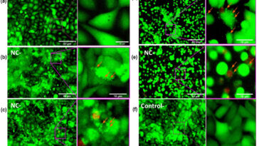 Les émissions de biomasse âgées pourraient présenter un risque plus important pour les poumons que la fumée de forêt fraîche