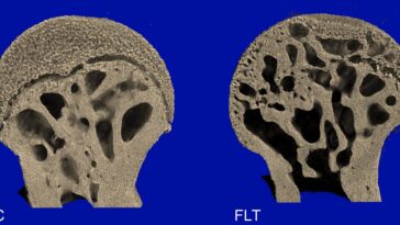 La perte de densité osseuse du fémur chez la souris à bord de l'ISS fait la lumière sur les défis de voyage dans l'espace