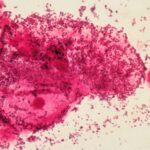 Les hommes prenant des antibiotiques pourraient réduire les taux de vaginose bactérienne chez les femmes