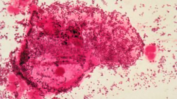 Les hommes prenant des antibiotiques pourraient réduire les taux de vaginose bactérienne chez les femmes