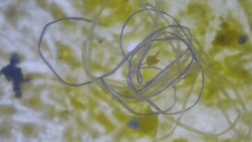 Les microplastiques liés au cancer des rivières sud-américains ont, selon les études, les études montrent