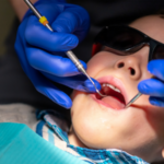 Deux villes ont cessé d'ajouter du fluorure à l'eau. La science révèle ce qui s'est passé Deux villes ont cessé d'ajouter du fluorure à l'eau. La science révèle ce qui s'est passé