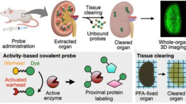 L'imagerie 3D à haute résolution révèle des différences d'activité enzymatique et des effets du médicament dans les organes entiers