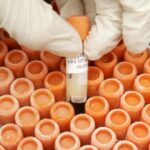 Les essais de Parkinson précoces font revivre les cellules souches comme un traitement possible