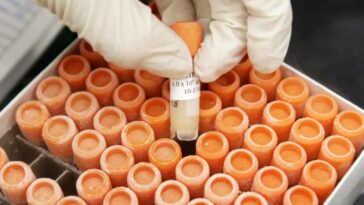 Les essais de Parkinson précoces font revivre les cellules souches comme un traitement possible