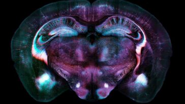 A light micrograph of a section of a whole mouse brain, with nerve cells colourfully labelled