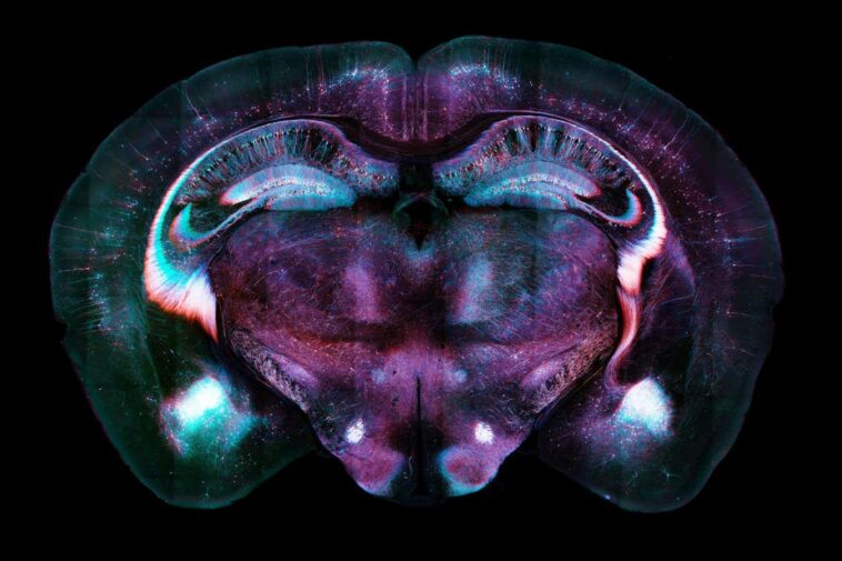 A light micrograph of a section of a whole mouse brain, with nerve cells colourfully labelled