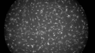 Les astrocytes des rats implactent la lumière, ce qui indique leur activité.