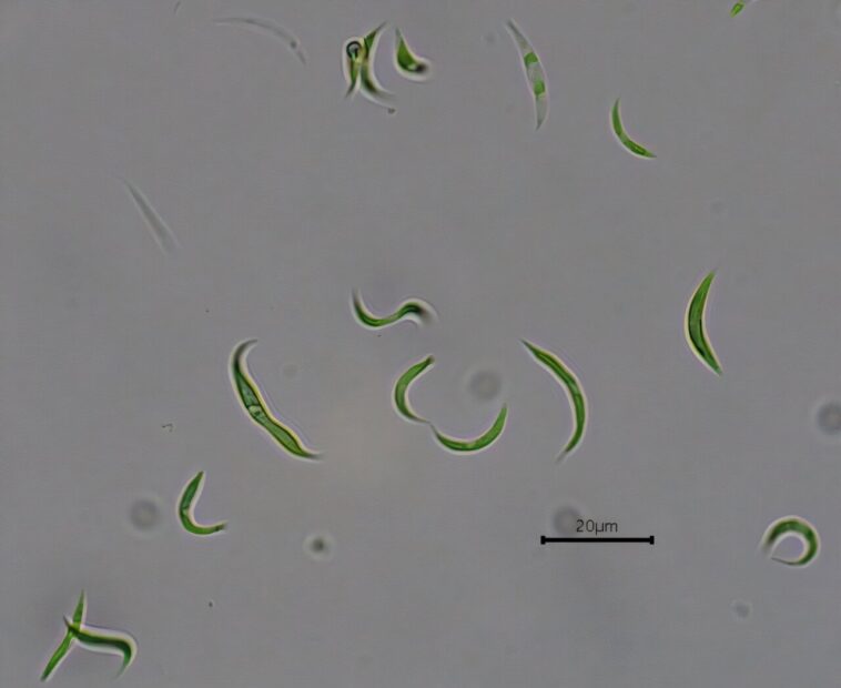 Les microalgues éliminent les résidus antibiotiques des eaux usées, réduisant la contamination environnementale