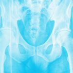 N'attendez pas la ménopause pour renforcer vos os