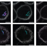 Une nouvelle étiquette moléculaire pourrait conduire à des tests de tuberculose plus simples et plus rapides