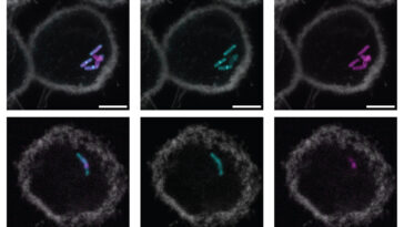 Une nouvelle étiquette moléculaire pourrait conduire à des tests de tuberculose plus simples et plus rapides
