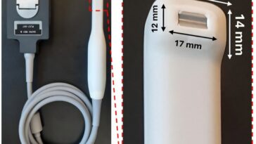 La brosse à dents à ultrasons promet des contrôles indolores pour les problèmes de gencives cachées