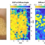 La polarimétrie térahertz détecte les changements de tissu microscopique liés au cancer et aux brûlures La polarimétrie térahertz détecte les changements de tissu microscopique liés au cancer et aux brûlures