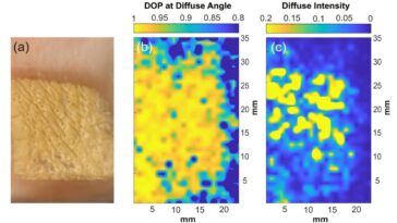 La polarimétrie térahertz détecte les changements de tissu microscopique liés au cancer et aux brûlures