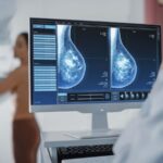 Le dépistage du cancer supplémentaire pourrait aider à ramasser les premiers cas dans les seins denses