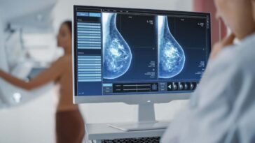 Le dépistage du cancer supplémentaire pourrait aider à ramasser les premiers cas dans les seins denses