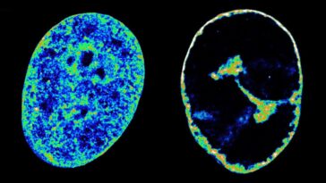 Human DNA in its natural state inside cells (left) compared to eight hours after being infected with the cold sore virus (right)