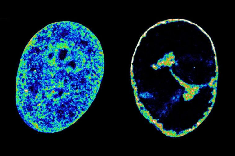 Human DNA in its natural state inside cells (left) compared to eight hours after being infected with the cold sore virus (right)