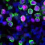 Lung tissue samples from mice, showing the nuceli of cells (blue), cancerous cells (green) and markers of proliferation (magenta)