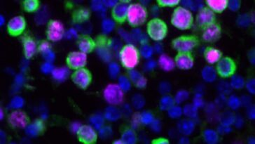 Lung tissue samples from mice, showing the nuceli of cells (blue), cancerous cells (green) and markers of proliferation (magenta)