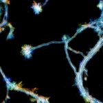 Developing brain cells from the hippocampus growing in culture