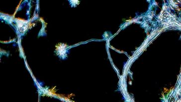 Developing brain cells from the hippocampus growing in culture