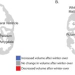 L'isolement antarctique provoque une perte de matière grise temporaire avec des changements thalamiques persistants