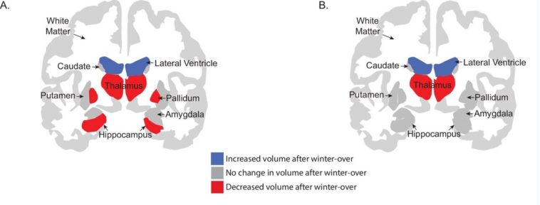 L'isolement antarctique provoque une perte de matière grise temporaire avec des changements thalamiques persistants