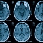La pandémie a peut-être vieilli notre cerveau avant même que nous ayons pris Covid-19
