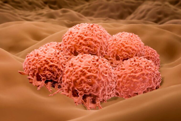 Le virus de l'herpès pourrait bientôt être approuvé pour traiter un cancer de la peau sévère