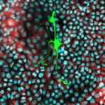 Les cellules cancéreuses volent les mitochondries des cellules nerveuses pour alimenter leur propagation