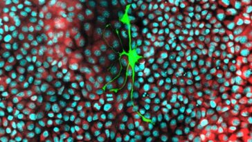 Les cellules cancéreuses volent les mitochondries des cellules nerveuses pour alimenter leur propagation