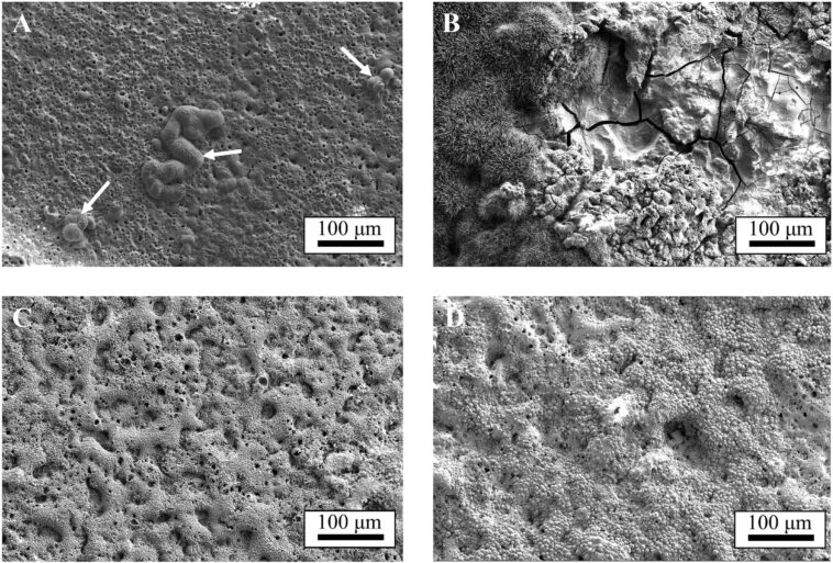 Les chercheurs révèlent comment la fabrication et le traitement de surface affectent la corrosion dans les alliages métalliques bioabsorbables Les chercheurs révèlent comment la fabrication et le traitement de surface affectent la corrosion dans les alliages métalliques bioabsorbables