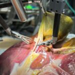 Les robots chirurgicaux font un pas vers des opérations entièrement autonomes