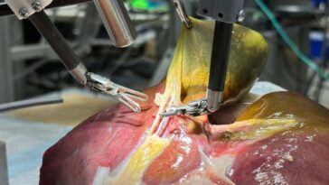 Les robots chirurgicaux font un pas vers des opérations entièrement autonomes