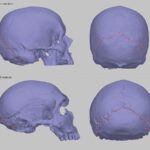 Un crâne en forme de Néandertal peut expliquer pourquoi certaines personnes ont des maux de tête