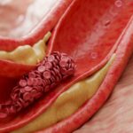 Une molécule produite par les microbes intestinaux peut aider à stimuler les maladies cardiaques Une molécule produite par les microbes intestinaux peut aider à stimuler les maladies cardiaques