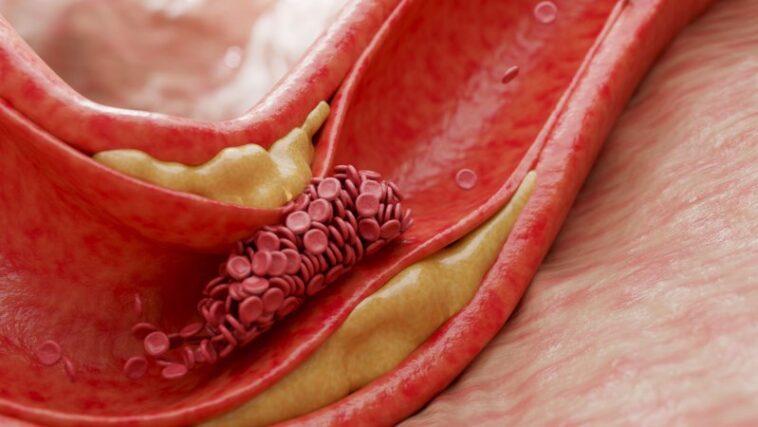 Une molécule produite par les microbes intestinaux peut aider à stimuler les maladies cardiaques