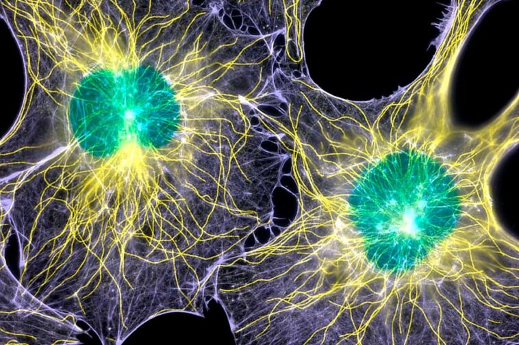 Fibroblast cells, which contribute to the formation of connective tissue but are also involved in scarring