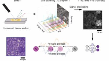 Deep Learning avance la spectrométrie de masse d'imagerie avec des détails histologiques virtuels