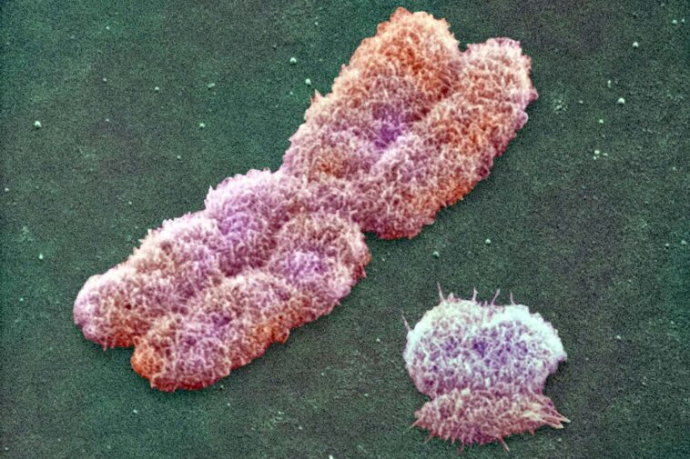 A human Y (right) and X chromosome seen with a scanning electron microscope