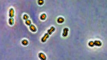 Le lait maternel pourrait aider à lutter contre les infections qui mettent en danger les grossesses