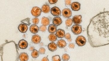 Electron micrograph of the HIV pathogen