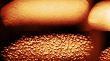 The top image shows an untreated bacterium; the bottom shows a bacterium after 90 minutes of being exposed to the antibiotic