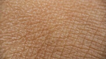 L'étirement de la peau pourrait permettre de donner des vaccins sans aiguille