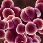 Les bactéries staphiques sont mauvaises pour laisser aller